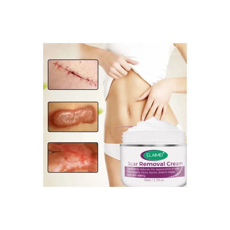 Crema Cicatrices Antimanchas Elaimei Hipoalergénica Sin Parabenos 50ml