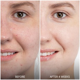 VGO Retinol Serum for Face, Resurfacing Retinol Serum with Hyaluronic Acid, Niacinamide and Ceramides, Hydrating and Refreshing, Wrinkle Smoothing, Suitable for Sensitive Skin (1 pack)