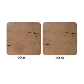 Crema Despigmentante Acido Kojico, Glicolico Y Vitamina C Todo Tipo De Piel