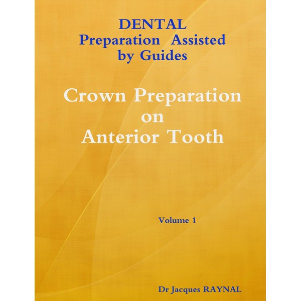 Dental Preparation Assisted By Guides Volume 1 Crown Preparation On