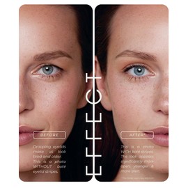 BOTÉ Eye Lift Strips for hooded eyes 144L I Invisible eyelid lifting tape