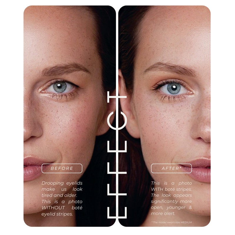 BOTÉ Eye Lift Strips for hooded eyes 144L I Invisible