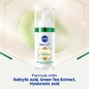NIVEA Luminous 630 Post-Acne Dark Marks Serum (30ml), Facial Serum