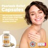 Strength & Spices Psoriasis Relief Skin Care Supplements, Immune System