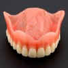 Dental Typodont Implant Teeth Model Clear Overdenture 4 Implants Maxillary