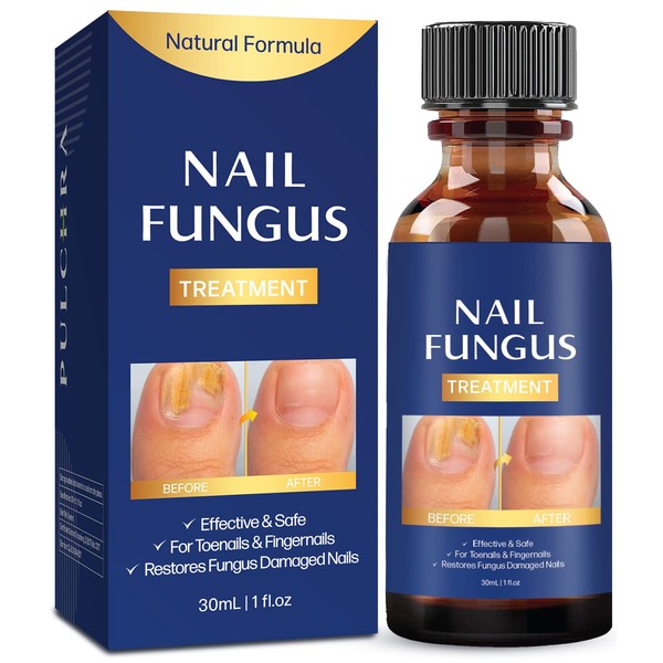 Toenail fungus treatment, Nail Fungus Treatment for Toenail, Toe Nail Fungus Treatment Extra Strength Effective Fingernail and Toenail Fungus Killer,Nail Repair Solution, Restoring Healthy Nails
