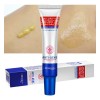 Bioaqua crema antiacné controla grasa y manchas, uso diario facial