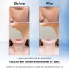 Face Massager - 7-Color Light Anti-Wrinkle Skin Tightening Neck Wrinkle