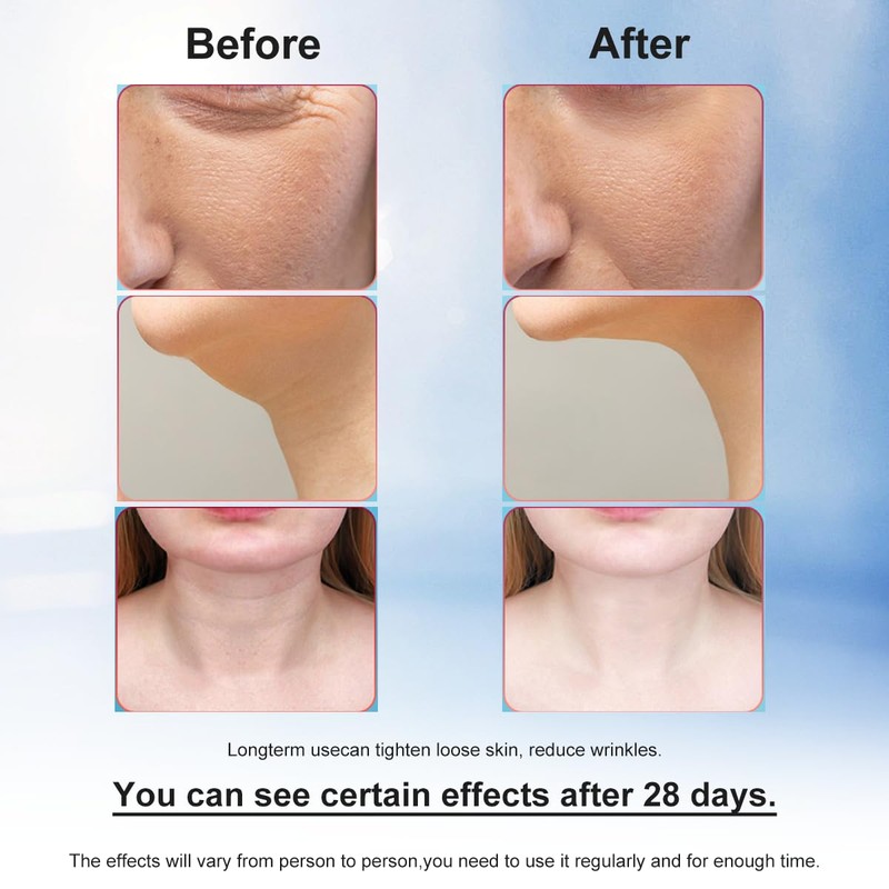 Face Massager - 7-Color Light Anti-Wrinkle Skin Tightening Neck Wrinkle