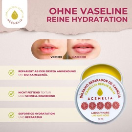 ACEMELIA Pack of two repairing lip balms, 2 x 10 ml, nose and lips, intensive care and moisture for dry and chapped lips, protection against cold and wind, vegan