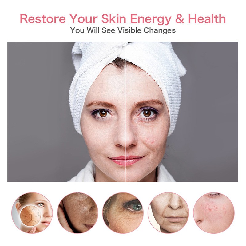 EMS Machine Electric Beauty Freckle Tight Five Color Light RF