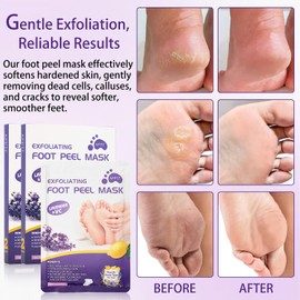 Foot Peel Mask, 4 Pairs Plantifique Foot Peel Mask for Hard Skin, Removes Dead Skin, Repair Cracked Heel, Footner Exfoliating Sock Moisturising Socks for Foot Care