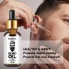 30 Ml Aceite Natural Para El Crecimiento La Barba Los