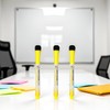 3 Pcs Yellow Magnetic Whiteboard Markers,Magnetic Pen Writing Drawing Erasable