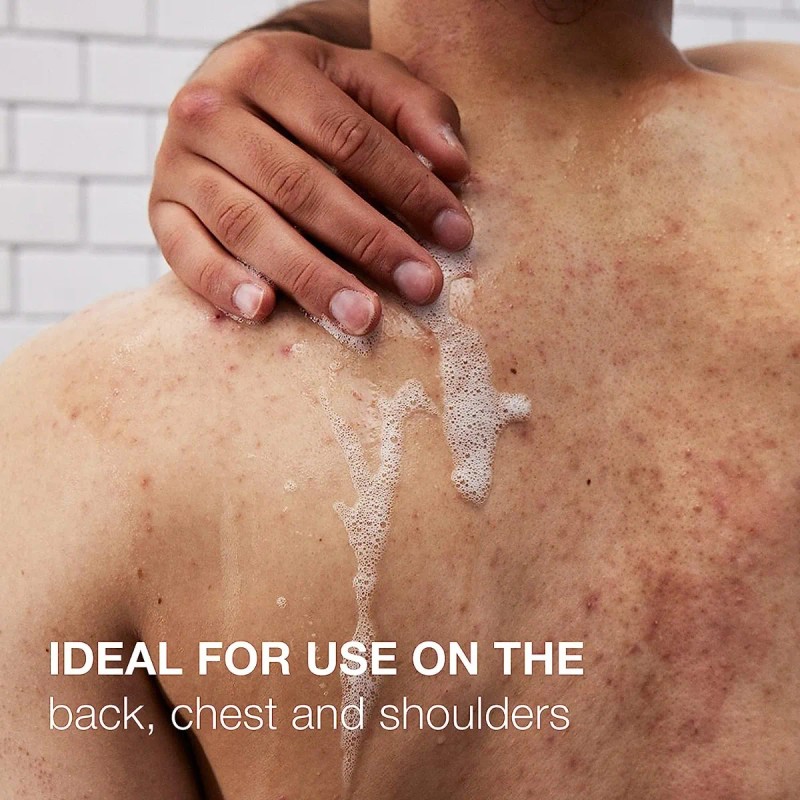 Neutrogena Limpiador Y Exfoliante De Acné Corporal. 8.5 Oz