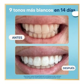 Tiras Blanqueadoras Dientes Lumineux Sin Peróxido 7 Tratami