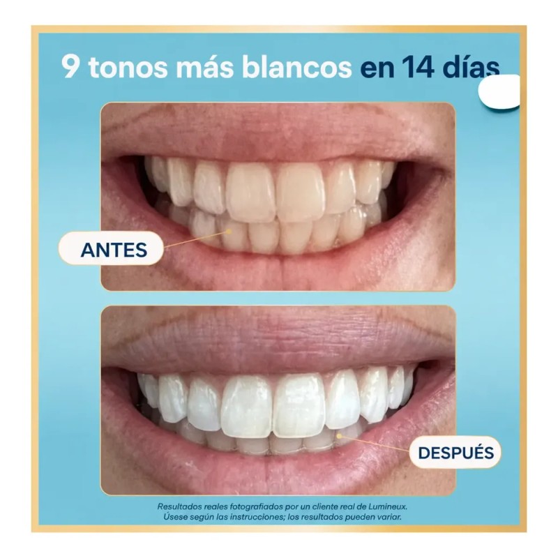 Tiras Blanqueadoras Dientes Lumineux Sin Peróxido 7 Tratami