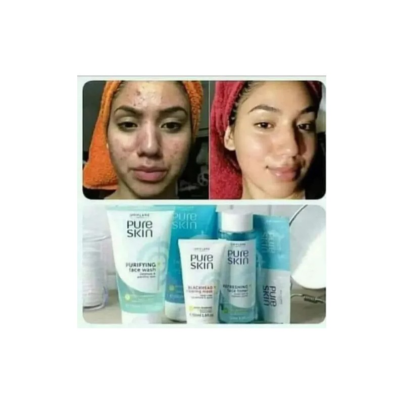 Limpiador Facial + Tónico + Humectante Pure Skin 3 Piezas