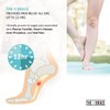 The Original X Brace - Arch Support Brace and Compression