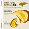 Batana Oil Set para Crecimiento Capilar | 100% Orgánico y