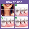 RIZUKO Floss Threaders,Deep Clean Dental Floss Threader for Braces,Bridges,Implants with