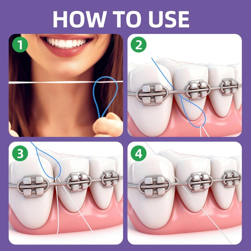 RIZUKO Floss Threaders,Deep Clean Dental Floss Threader for Braces,Bridges,Implants with