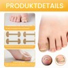 Zolara Pack of 80 Toenail Patch, Toenail Correction Patch, Plaster