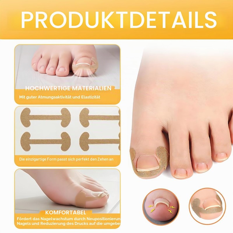 Zolara Pack of 80 Toenail Patch, Toenail Correction Patch, Plaster