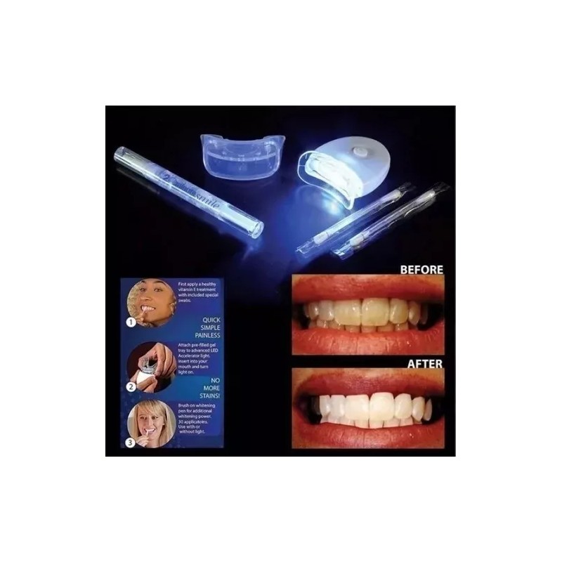 20 MINUTOS Blanqueador Dental 20 Minutos Con Lampara Ultra Violeta