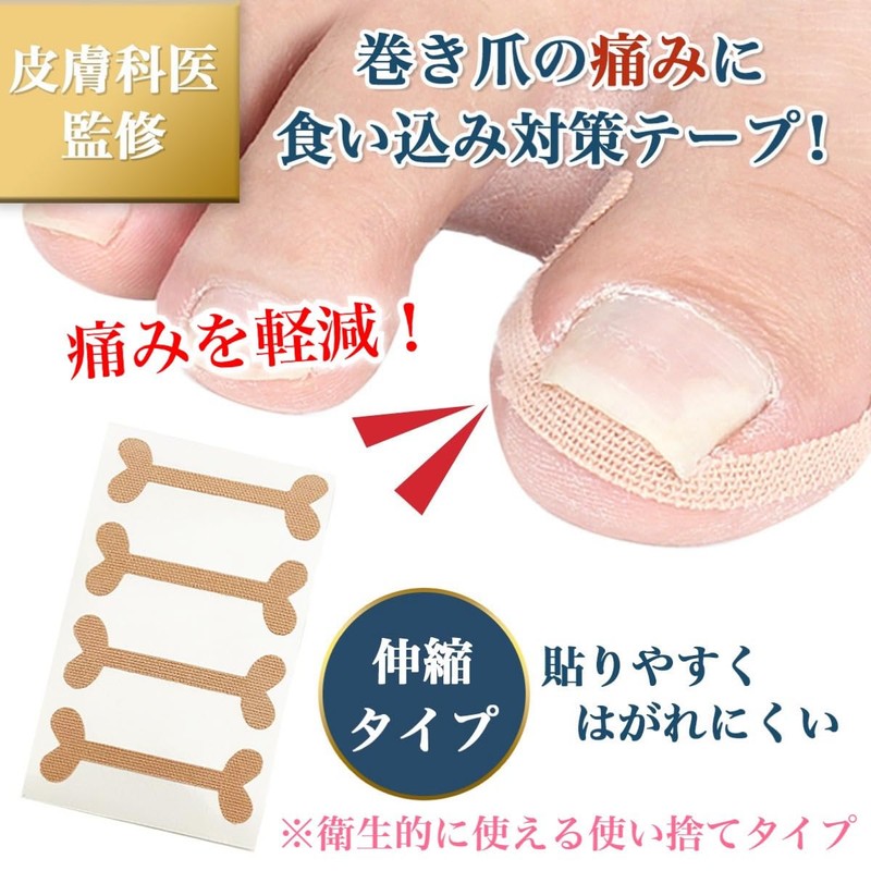 Dermatologist Supervised Nail Tape, 60 Sheets, Makizume Tape, Crinkle Nail