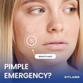 ZITLABS Pimple Patches for Face | Hydrocolloid Acne Patches with Tea Tree Oil & Salicylic Acid | For Zits, Blemishes, Breakouts | Medical-Grade Hydrocolloid | Overnight PM Patches | Pack of 72