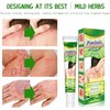 Crema Natural A Base De Hierbas Antipicazón, Crema Para Psoriasis