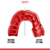 OPRO Protector Bucal Deportivo Self Fit Nivel de Proteccion 2
