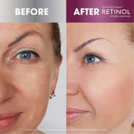 Retinol Enriquecido Skincare Ldel Cosmetics, Sérum Facial An                                                                                          