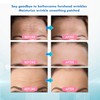 Rossy Forehead Wrinkle Patches: Forehead Wrinkles Treatment - Anti Wrinkle