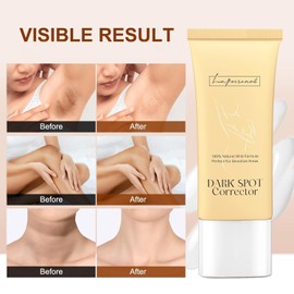 Dark Spot Remover Cream, LA.PERSONAL Pigment Spot Remover for Armpits, Knees, Elbows, Bikini Area, Inner Thigh, Moisturising Cream for Men and Women 2.14 oz/60 g