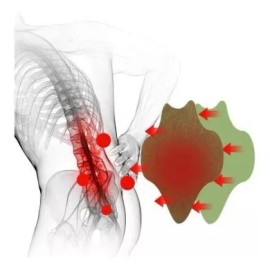 100 Pzs Parche Natural Dolor Cuello Espalda Lumbar Saluvera