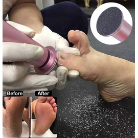 Electric Foot File for Dead Skin Removal with Replacement Pads (Pink)