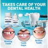 Tooth Filling Repair Kit, Temporary Fixing, Regain Confidence Smile, for