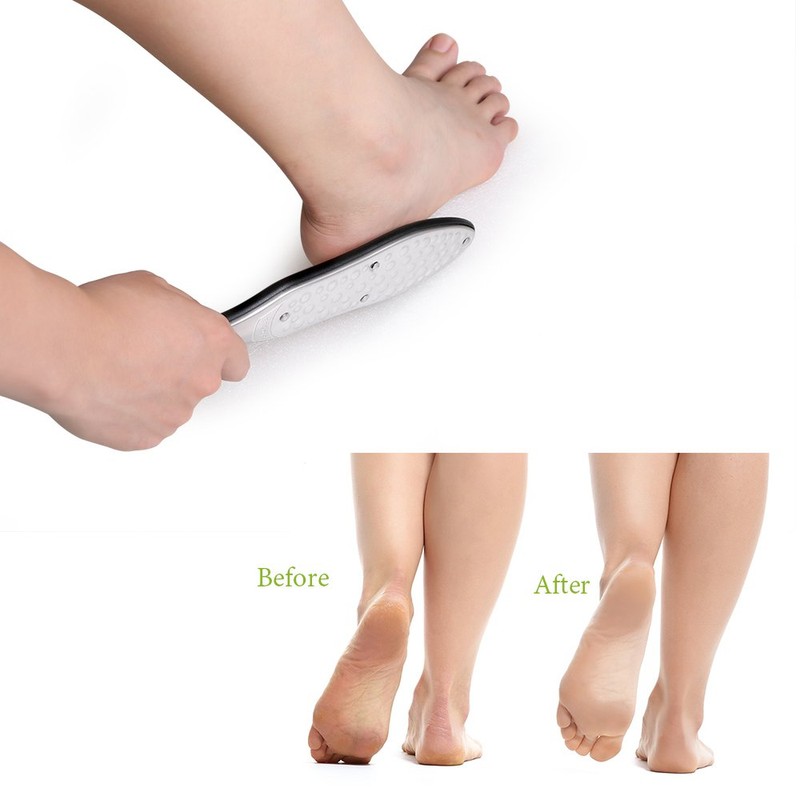 BEZOX Foot File Callus Remover, Heavy Duty Stainless Steel Foot