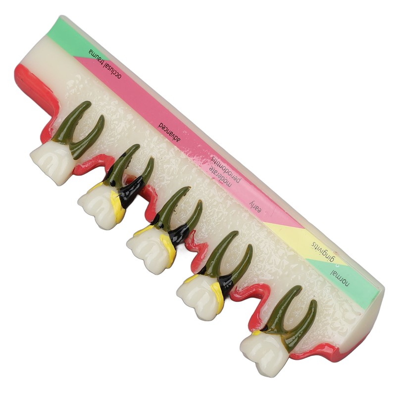 Dental Teeth Model Ceramic Clear Structure Oral Care Educational Periodontal