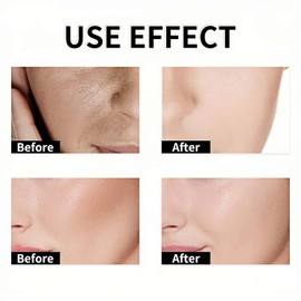 Skin Repair Crea/m with Black Rice,Rice Moisturiser and F/ace Firming C/ream,Face Moisturizer for Women with Skin Tightening,Wrinkle C/ream and Face Lift Cream,Repair Cream,Ski/n Tightening C/ream