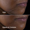 Smart Clinical Repair Lifting Face + Neck Cream | Crema
