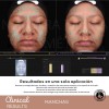 Espuma Micelar Mandélico 10% Combate Manchas/arrugas