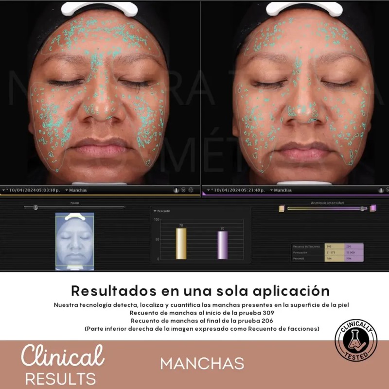 Espuma Micelar Mandélico 10% Combate Manchas/arrugas