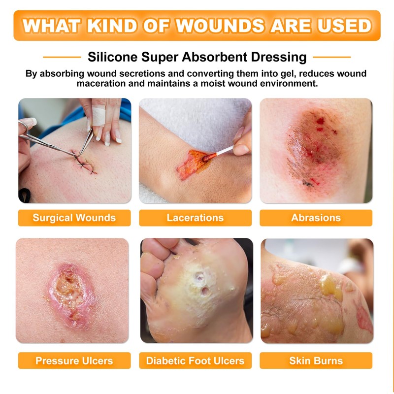 Carbou Silicone Super Absorbent Wound Dressing 5"x 5", 10 Individual