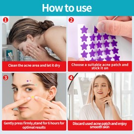 LBLMAX 648 Counts Pimple Patches,Cute Acne Patches for Face,Zit Patch,Hydrocolloid Spot Dots with Salicylic Acid and Tea Tree Oil