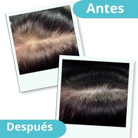 Kit De 3 Shampoos De Cacahuananche+7 Hierbas, 100% Natural