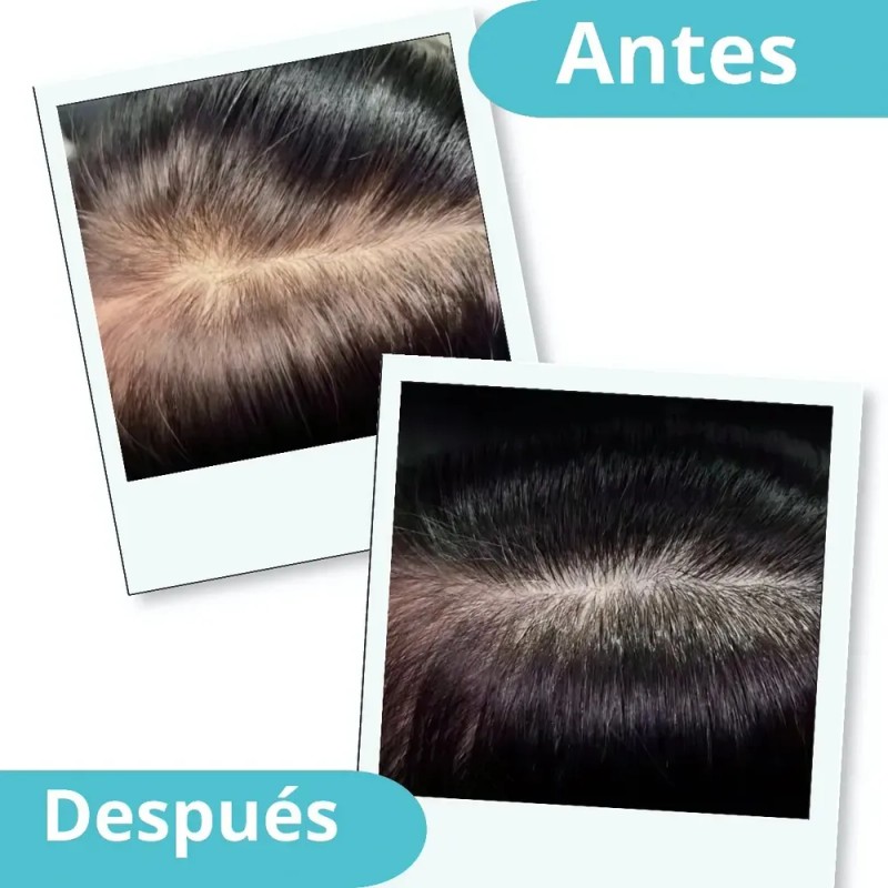 Kit De 3 Shampoos De Cacahuananche+7 Hierbas, 100% Natural