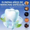 Mydear Tiras Blanqueadoras Dientes,14 Piezas Whitening Strips Profesional Blanqueador Dental,